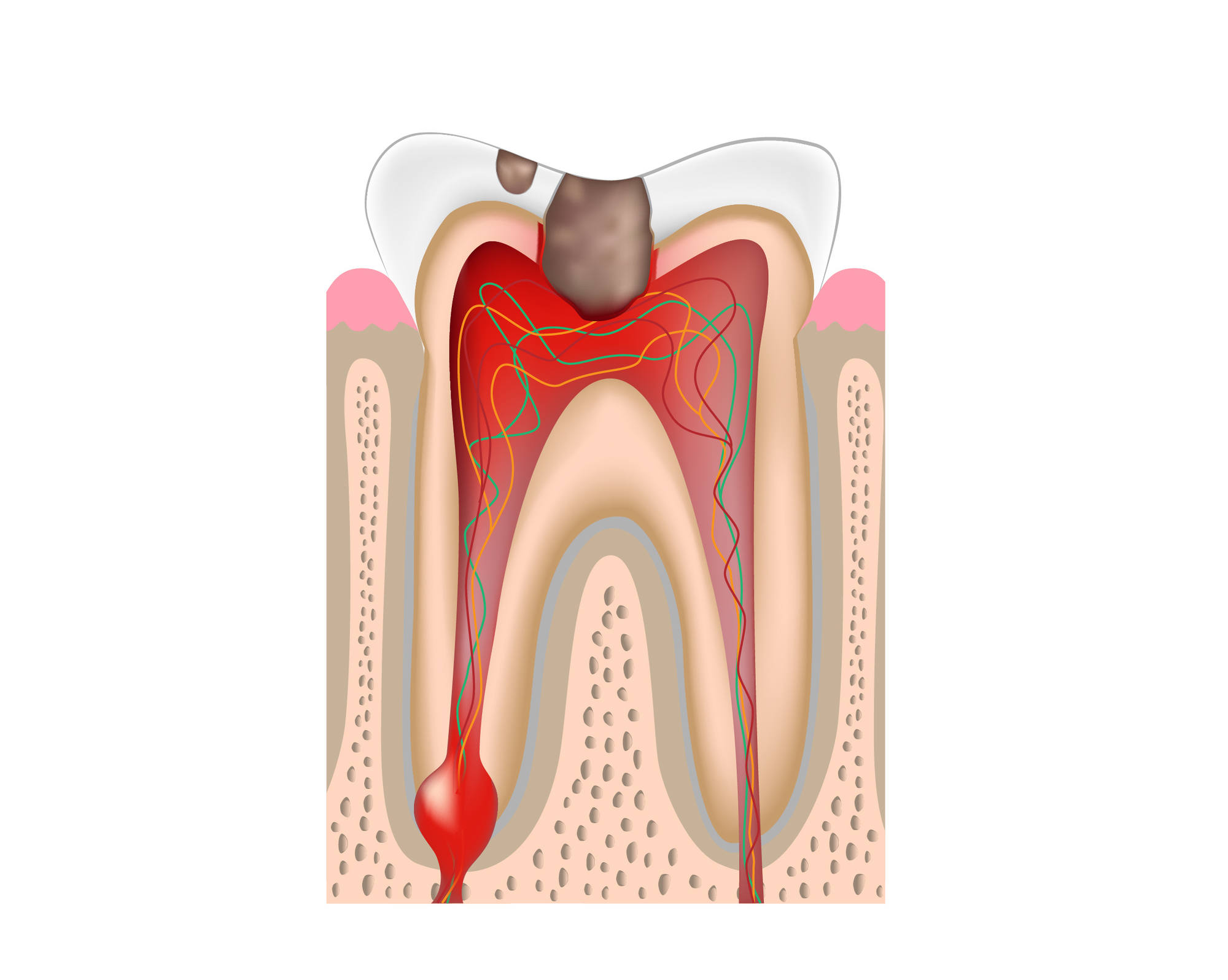 歯の状況を確認